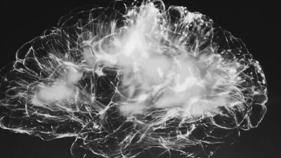 black and white image of a brain scan